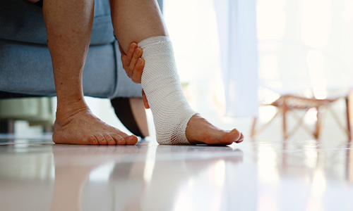 Persona mayor sufre de úlcera en su pierna